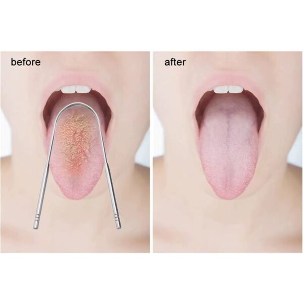 Gratte-Langue en Acier Inoxydable – Édition Premium Rose Gold – Image 2